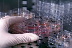 Santa Maria: contro la Sla il primo trapianto al mondo di cellule staminali cerebrali
